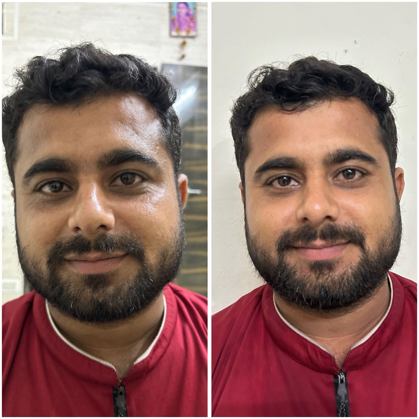 Before and After 10
