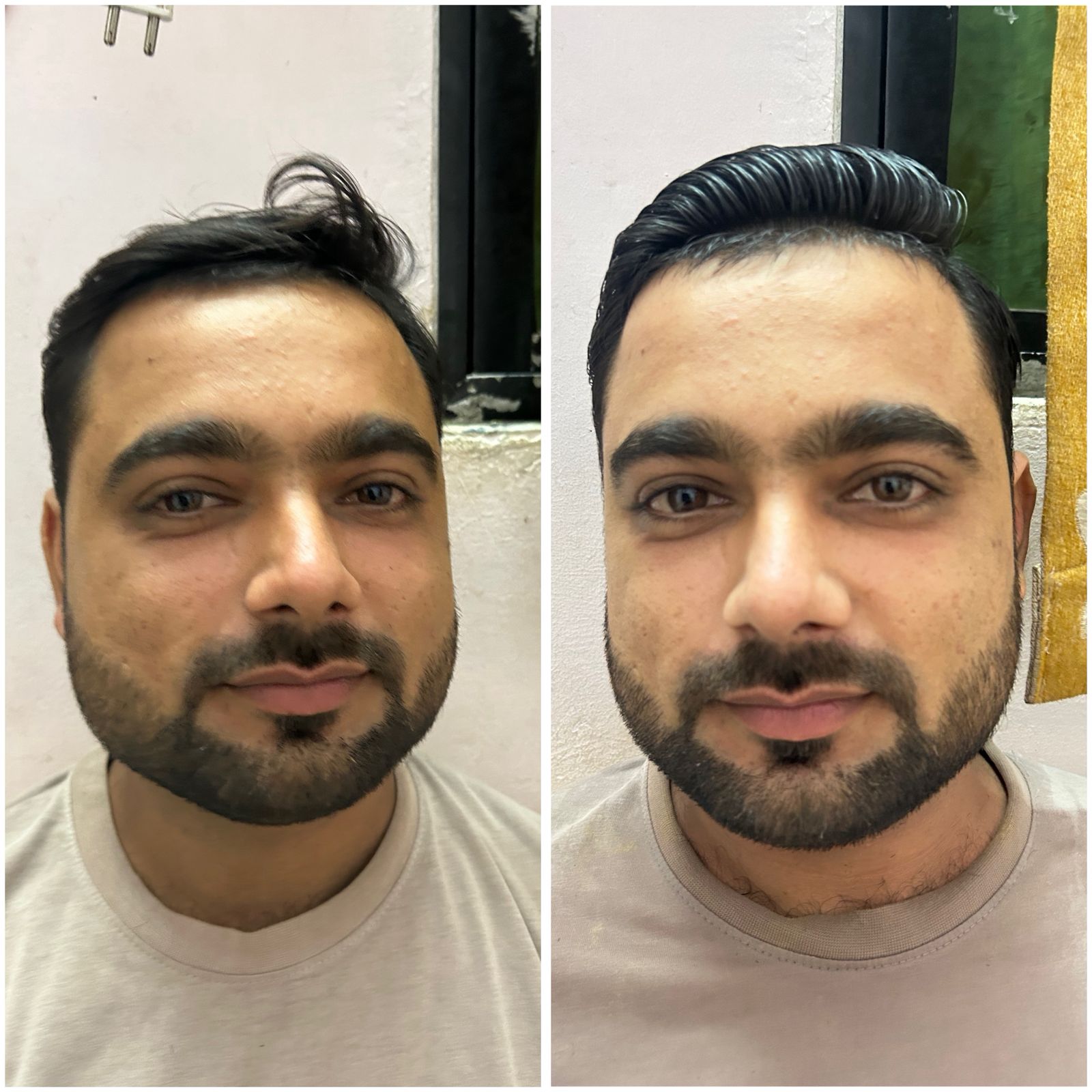 Before and After 12