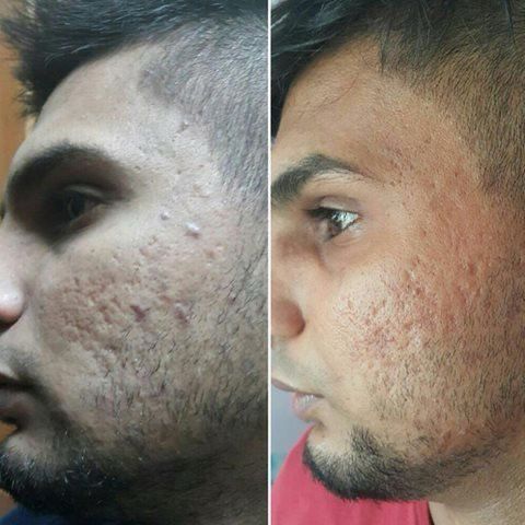 Before and After 2