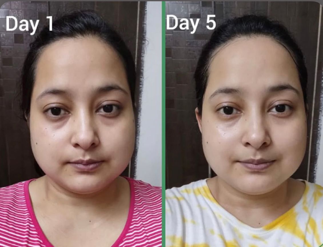 Before and After 3