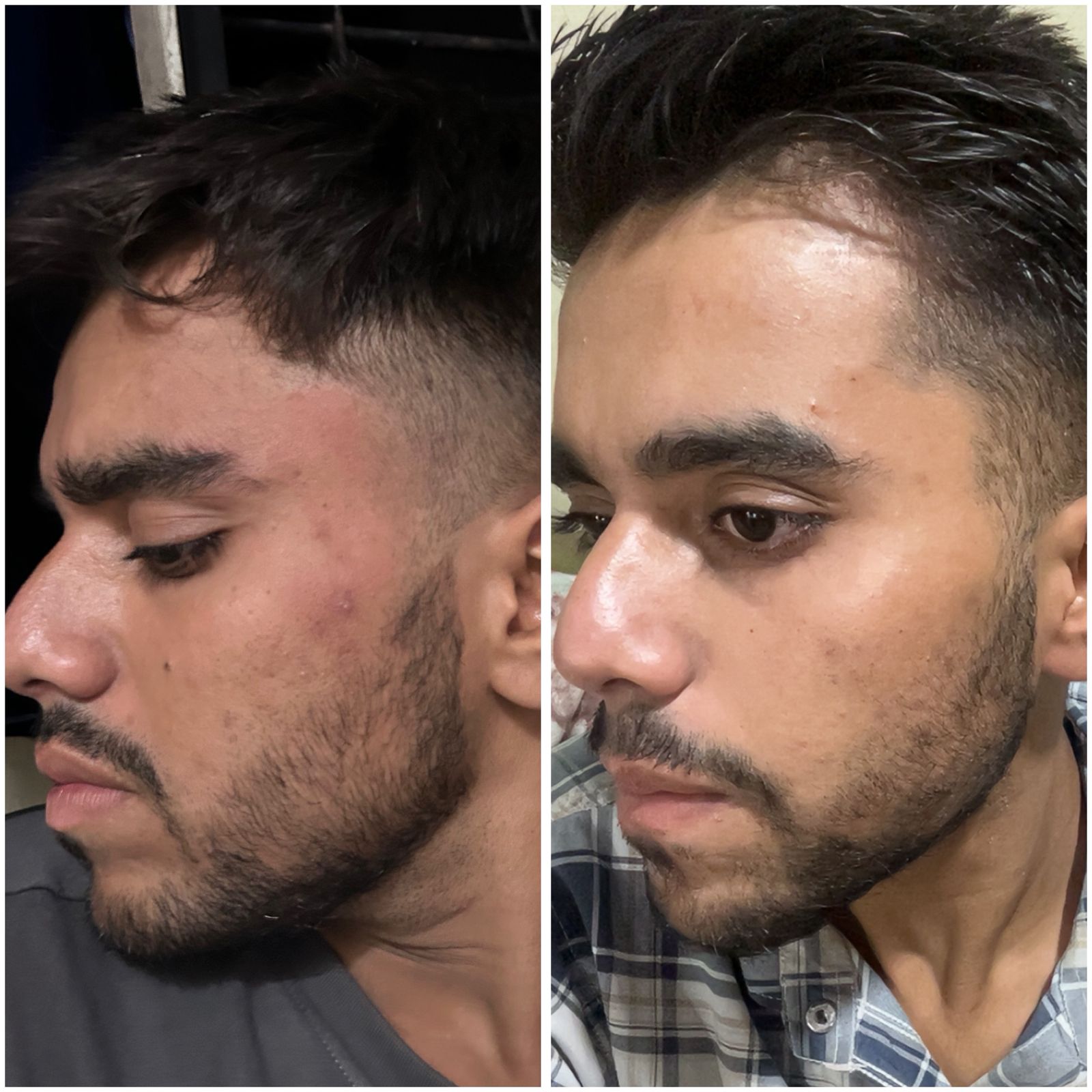 Before and After 7
