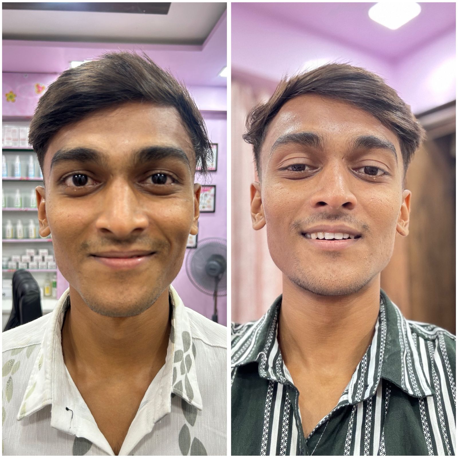Before and After 6