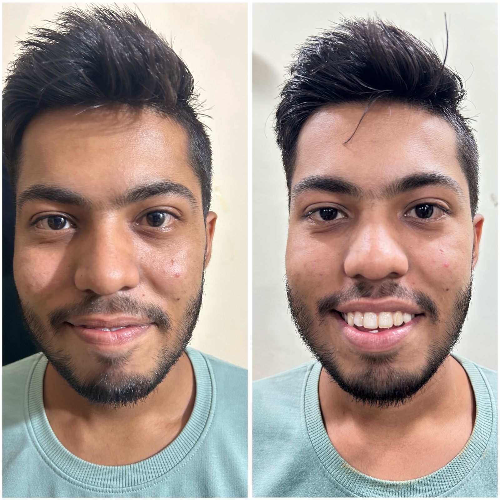 Before and After 4