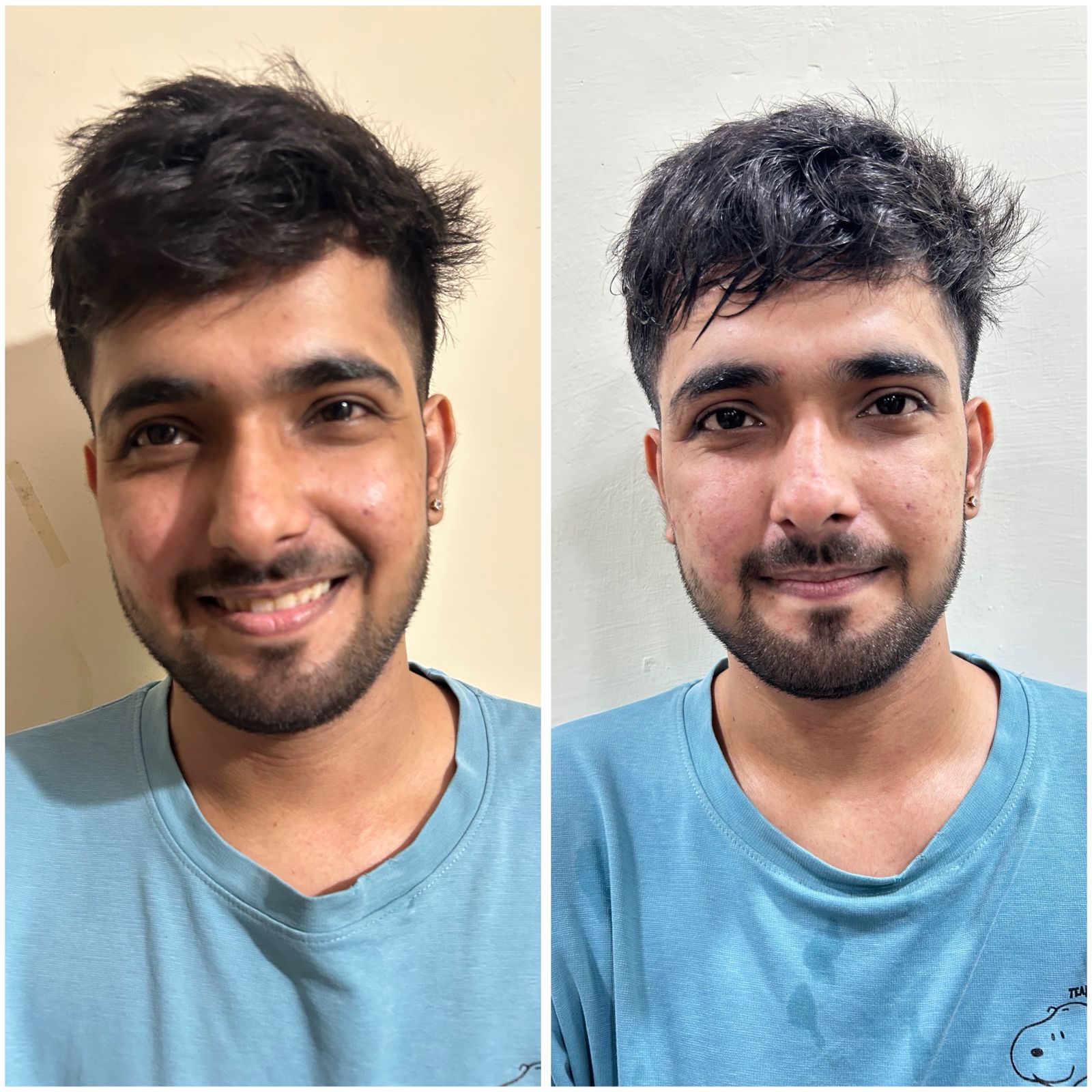 Before and After 9