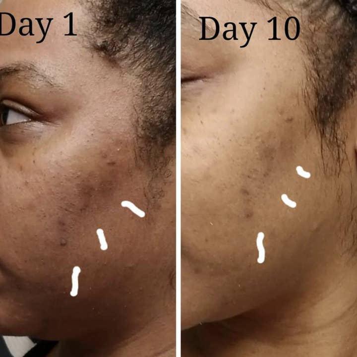 Before and After 5